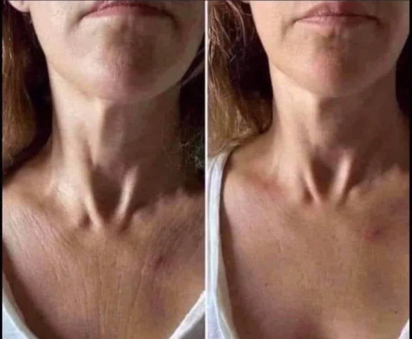 ageLOC® Dermatic Effects (Firming Cream)