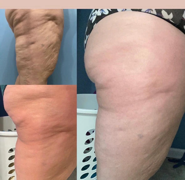 ageLOC® Dermatic Effects (Firming Cream)
