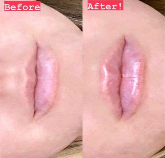 Lip Plumping Balm