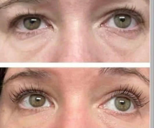 LumiSpa® IdealEyes®