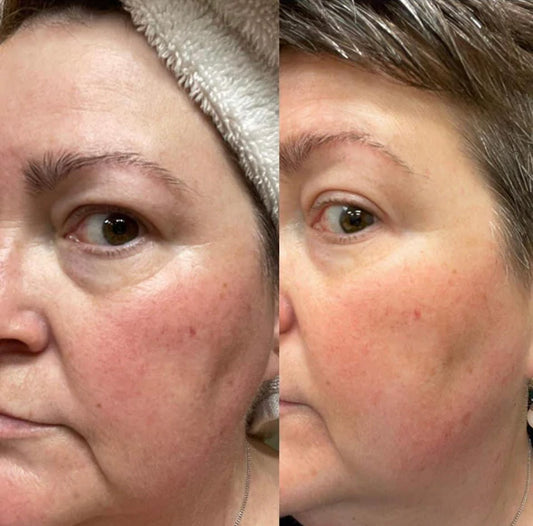 ageLOC® Tru Face® Essence Ultra Uplifting Cream