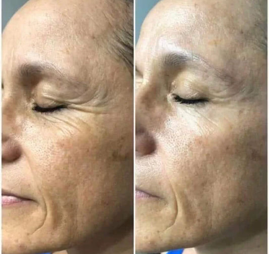 Tru Face® Line Corrector